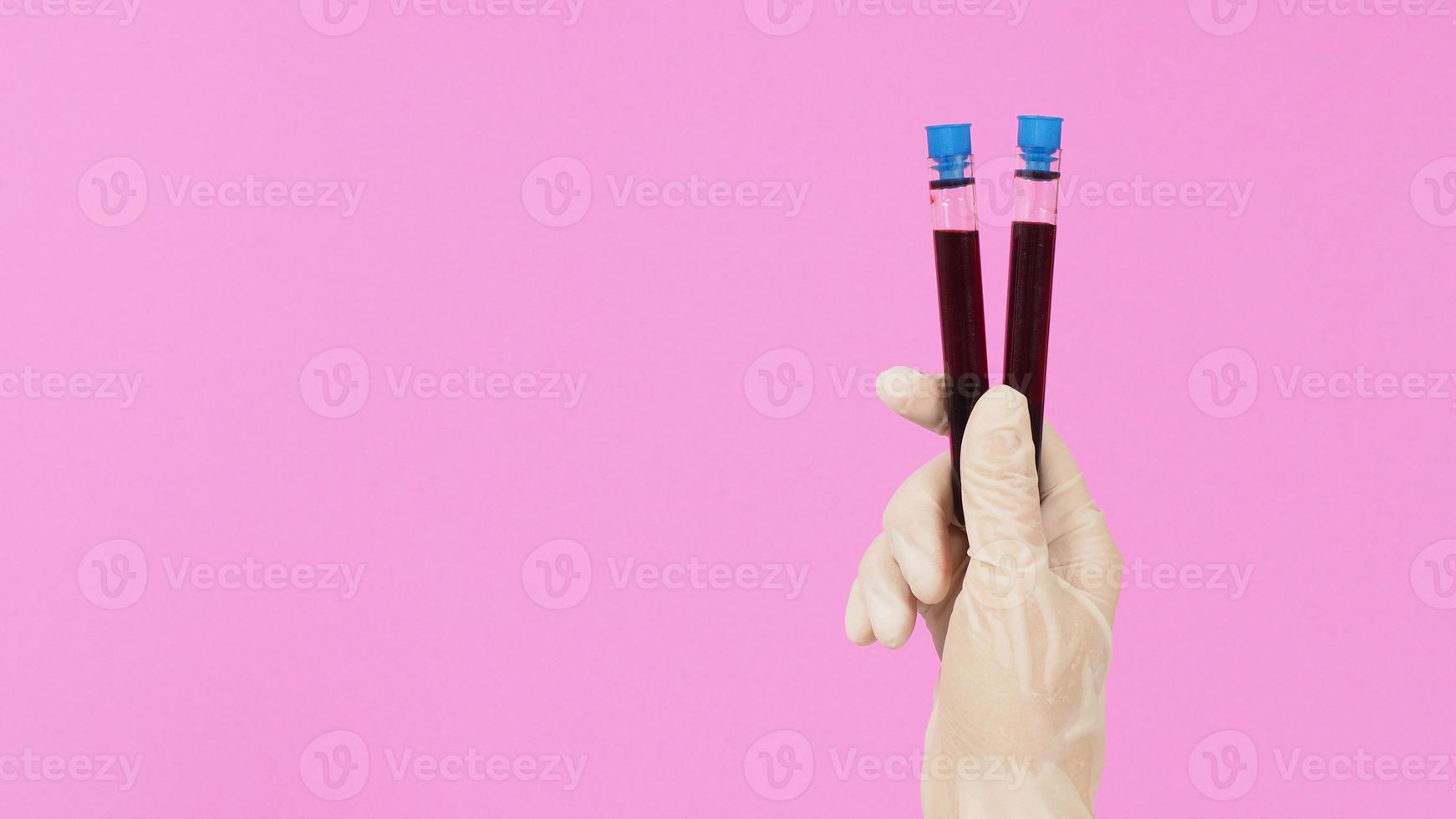 il mano è Tenere Due sangue test tubi su rosa sfondo. mano indossa un' bianca medico guanto. foto