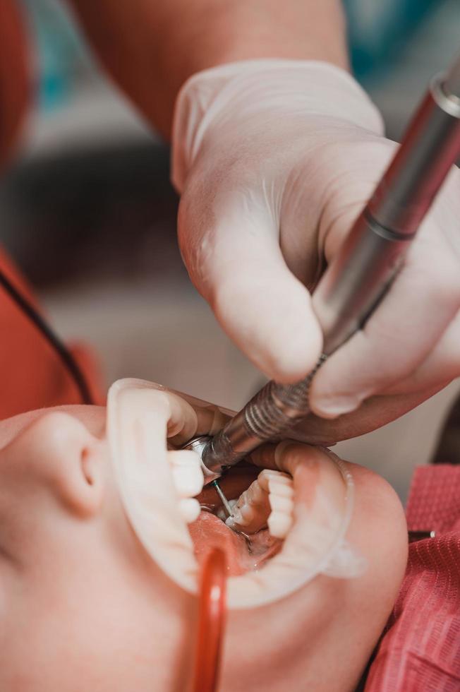 dentista pulisce dente decadimento nel un' bambino con un' trapano, nel il del bambino bocca espulsore saliva. foto