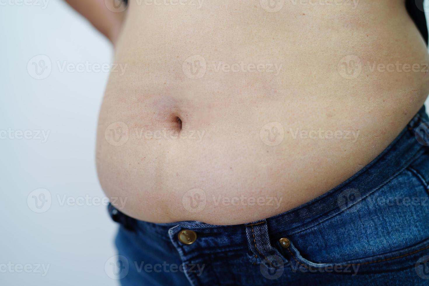 donna asiatica mostra pancia grassa di grandi dimensioni sovrappeso e obesità in ufficio. foto