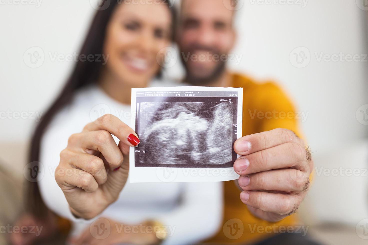 giovane incinta donna e marito Tenere ultrasuono scansione foto e sorridente.