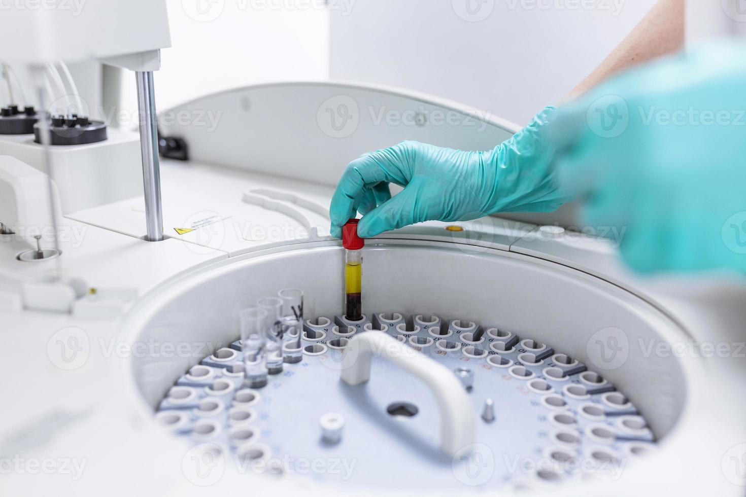 mani di femmina ricercatore Caricamento in corso campioni nel centrifuga nel laboratorio foto