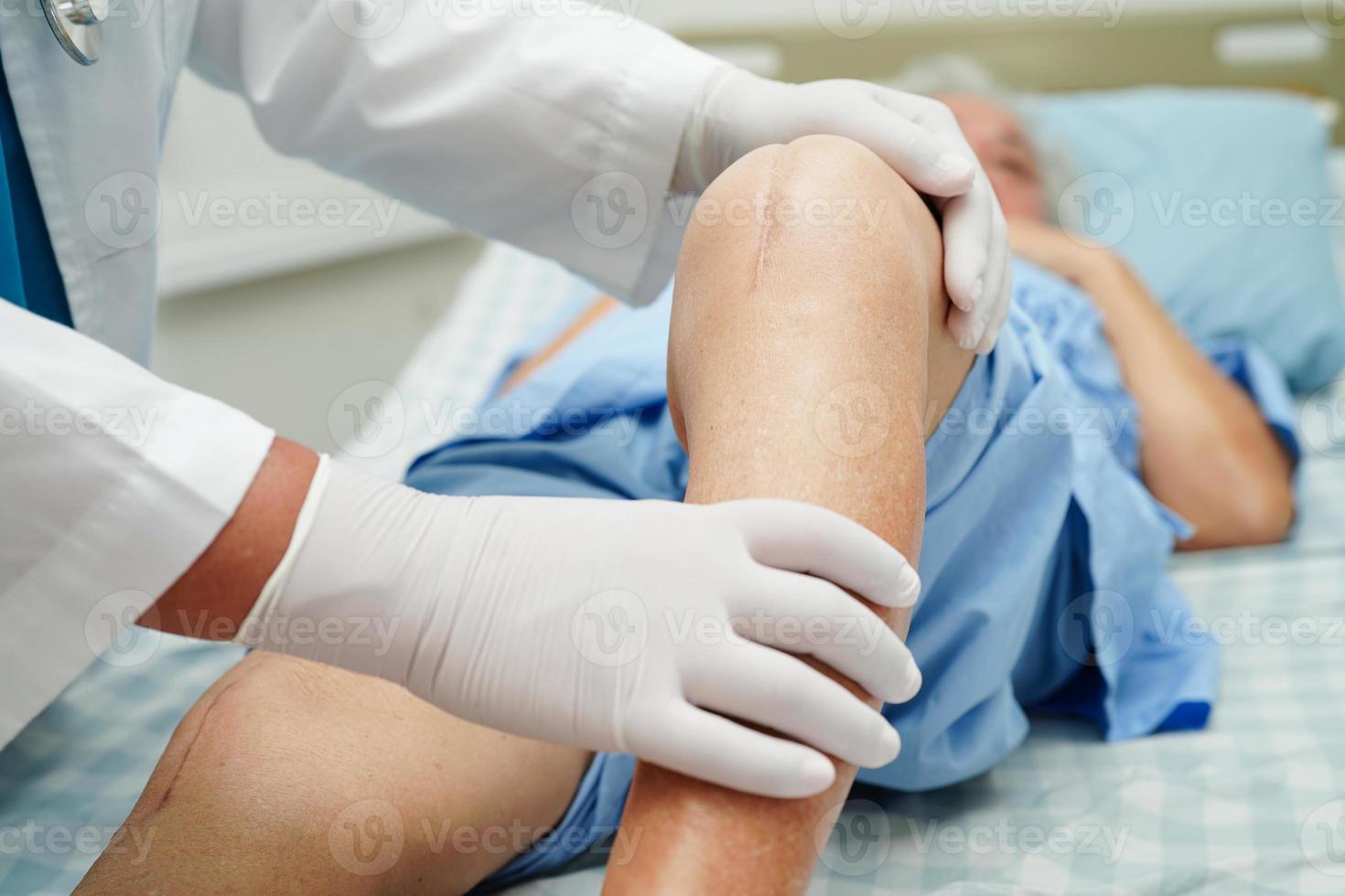 medico che controlla paziente donna anziana asiatica con chirurgia sostitutiva del ginocchio cicatriziale in ospedale. foto