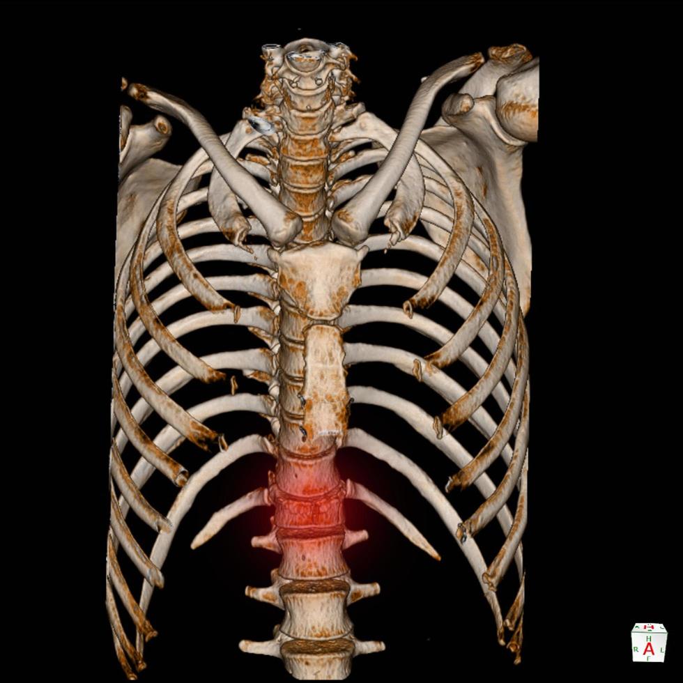 ct scansione 3d rendere umano scheletro sistema toracica scheletro anatomia . foto