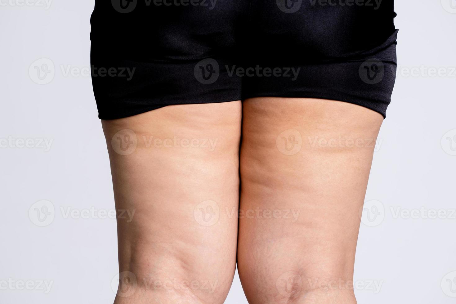 femmina gambe con cellulite. pelle e corpo cura concetto. foto