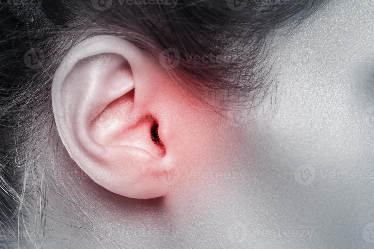 avvicinamento di femmina orecchio con fonte di dolore foto