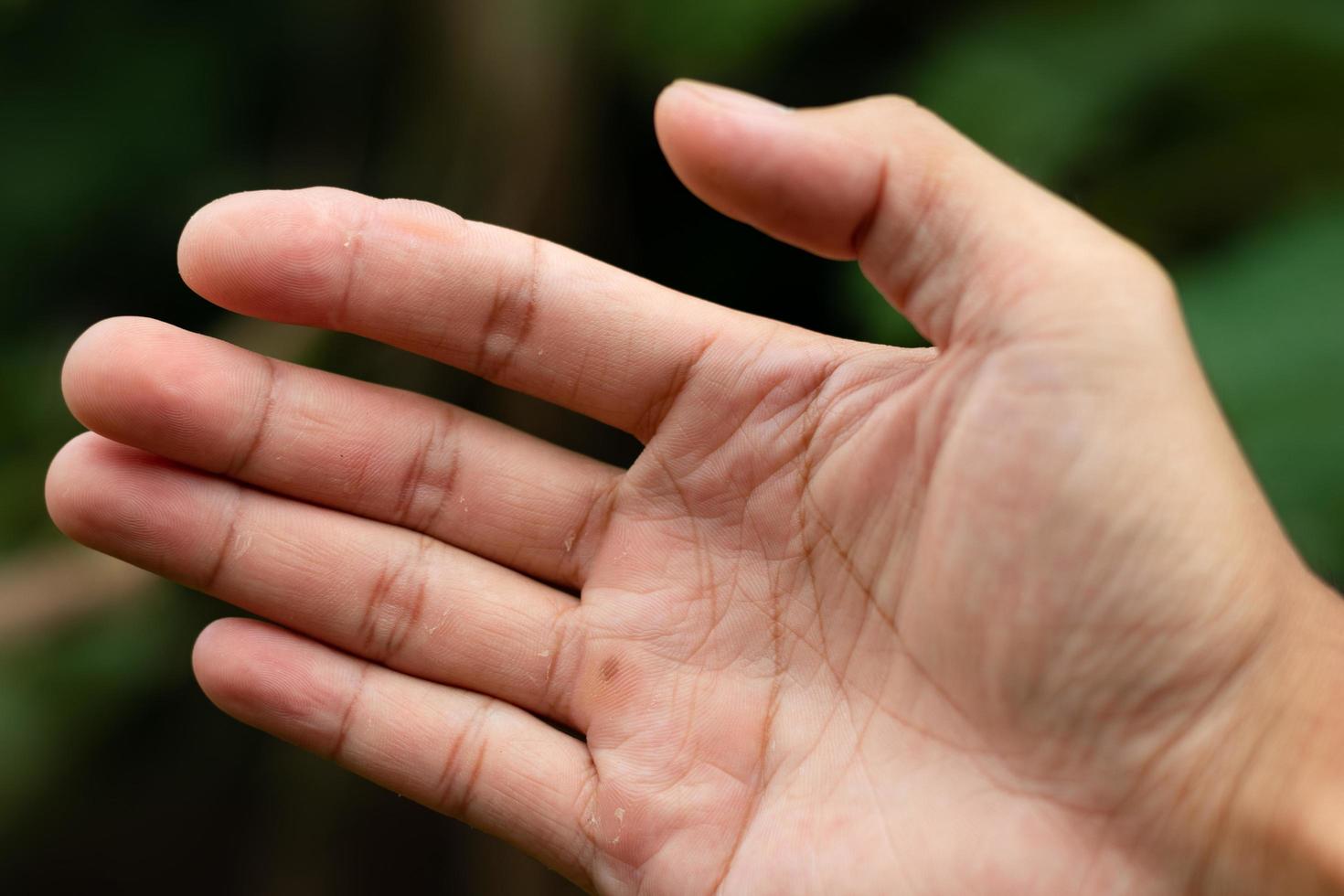 primo piano di una mano con un blister foto