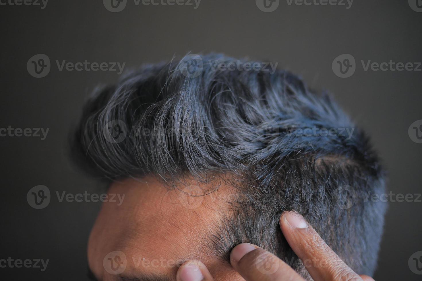 concetto di perdita di capelli con l'uomo che controlla i suoi capelli foto