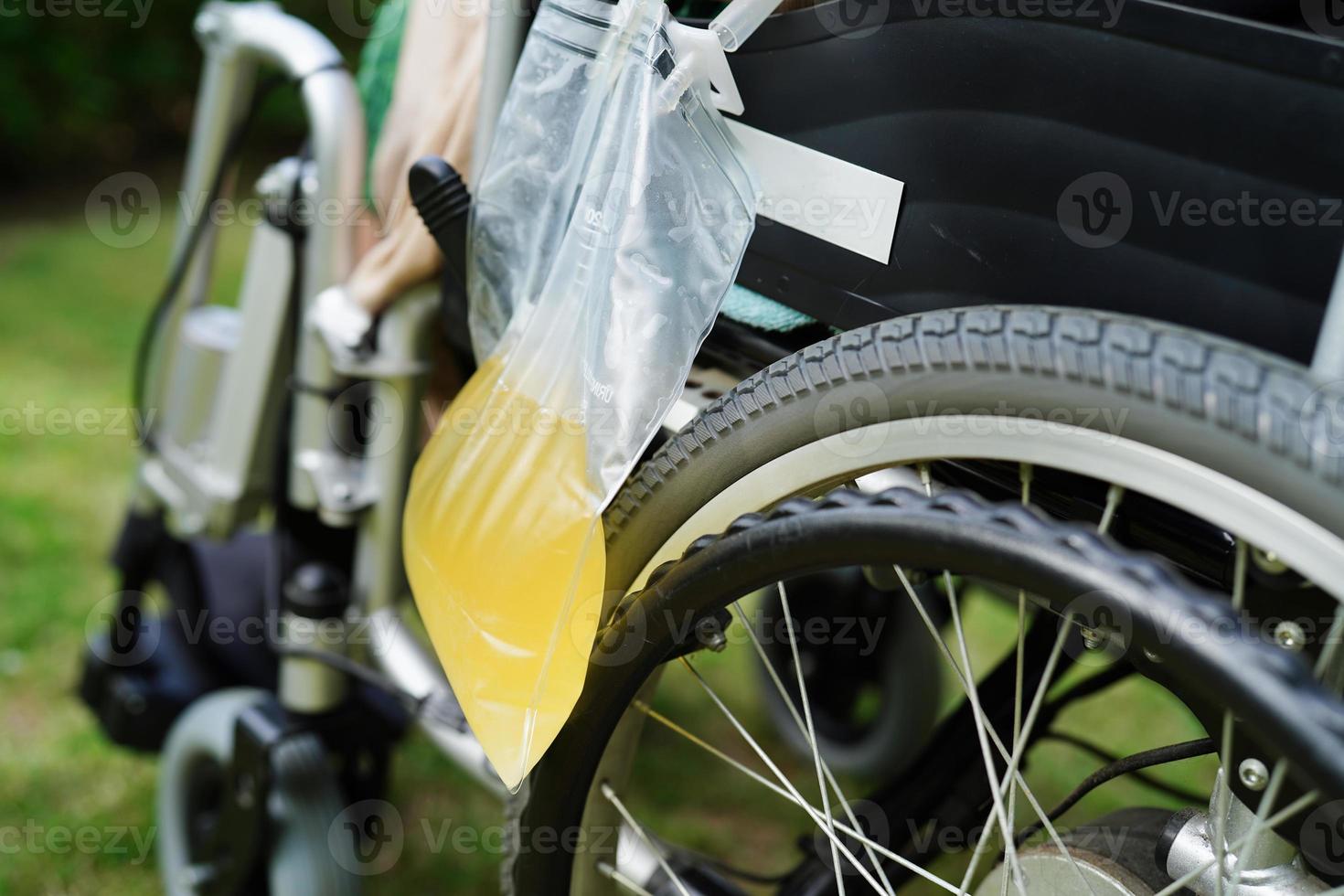 donna asiatica di disabilità con sacchetto di urina sulla sedia a rotelle. foto