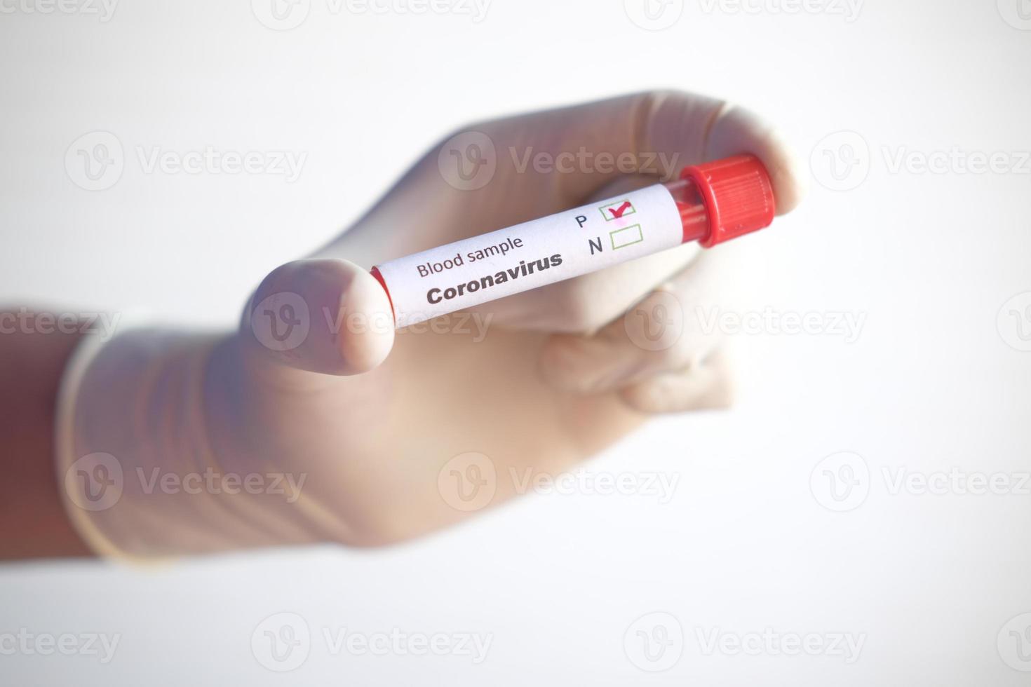 campione covid in tubo rosso foto