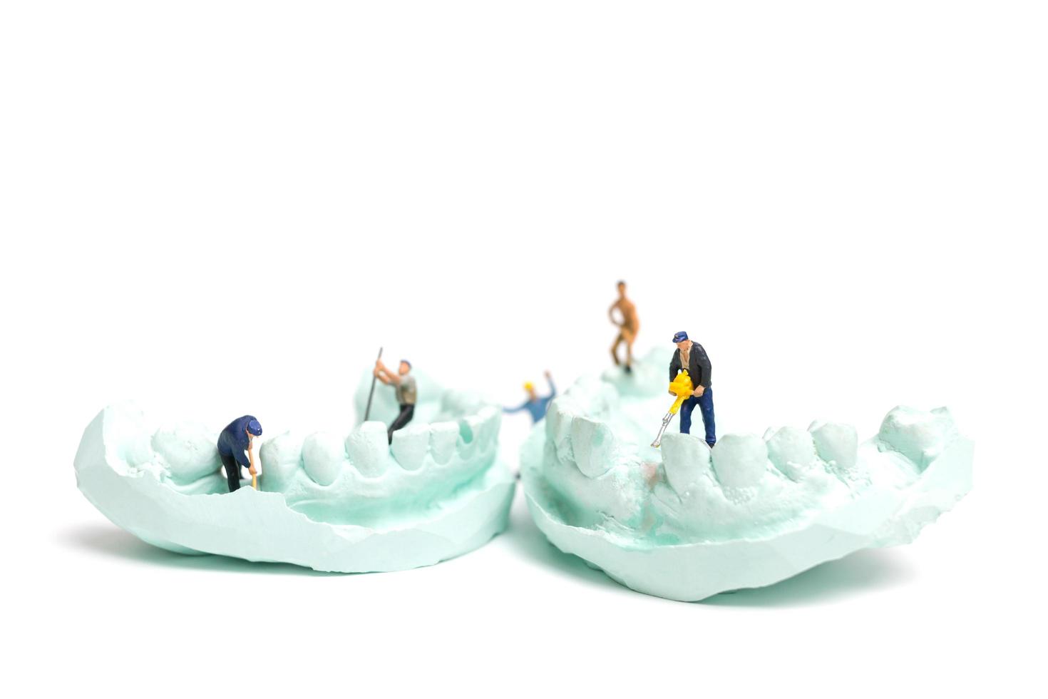 lavoratori in miniatura che riempiono i denti finti e li inseriscono in una protesi realizzata con gesso, concetto di laboratorio di protesi dentale foto