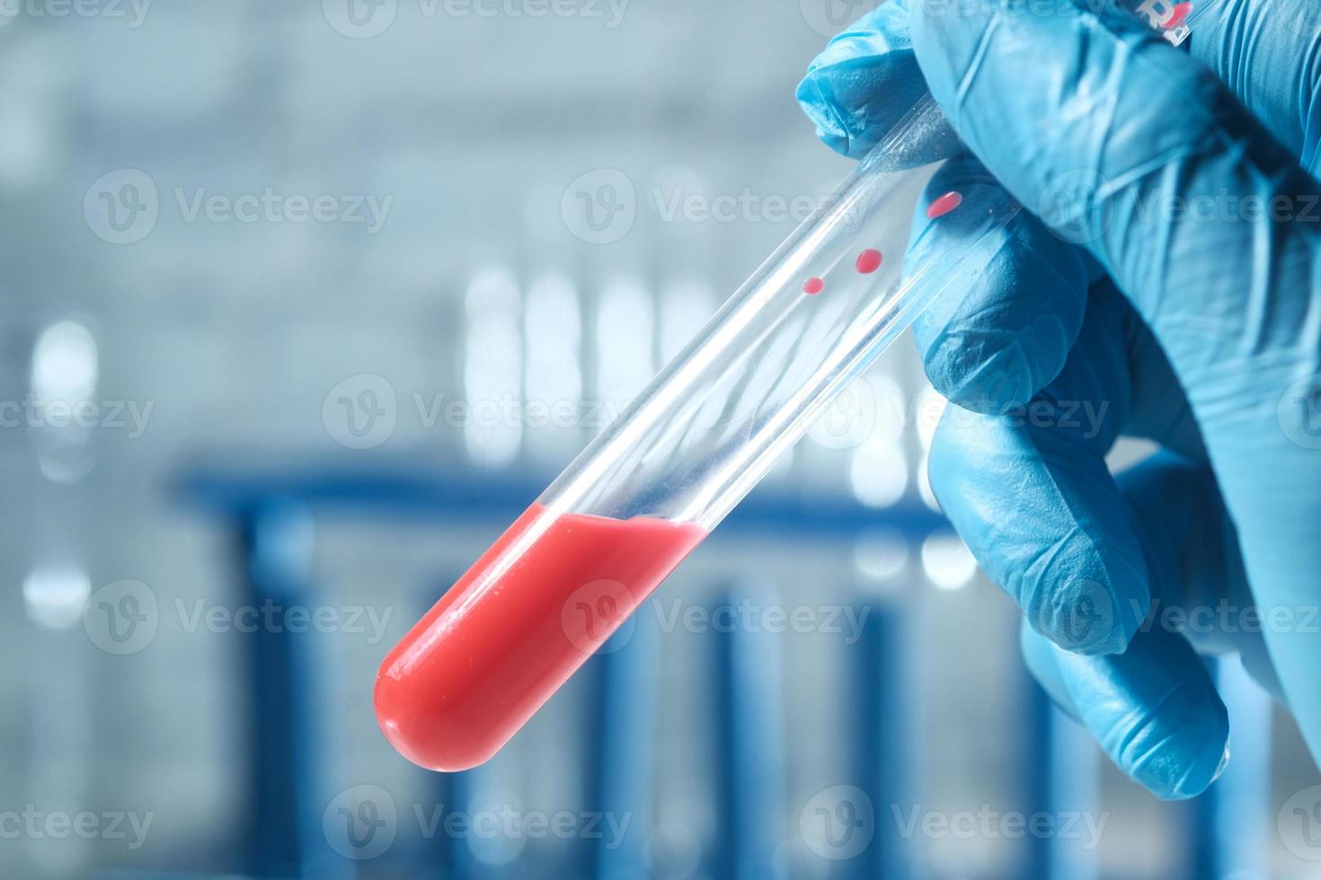 Close up di liquido rosso in una fiala foto