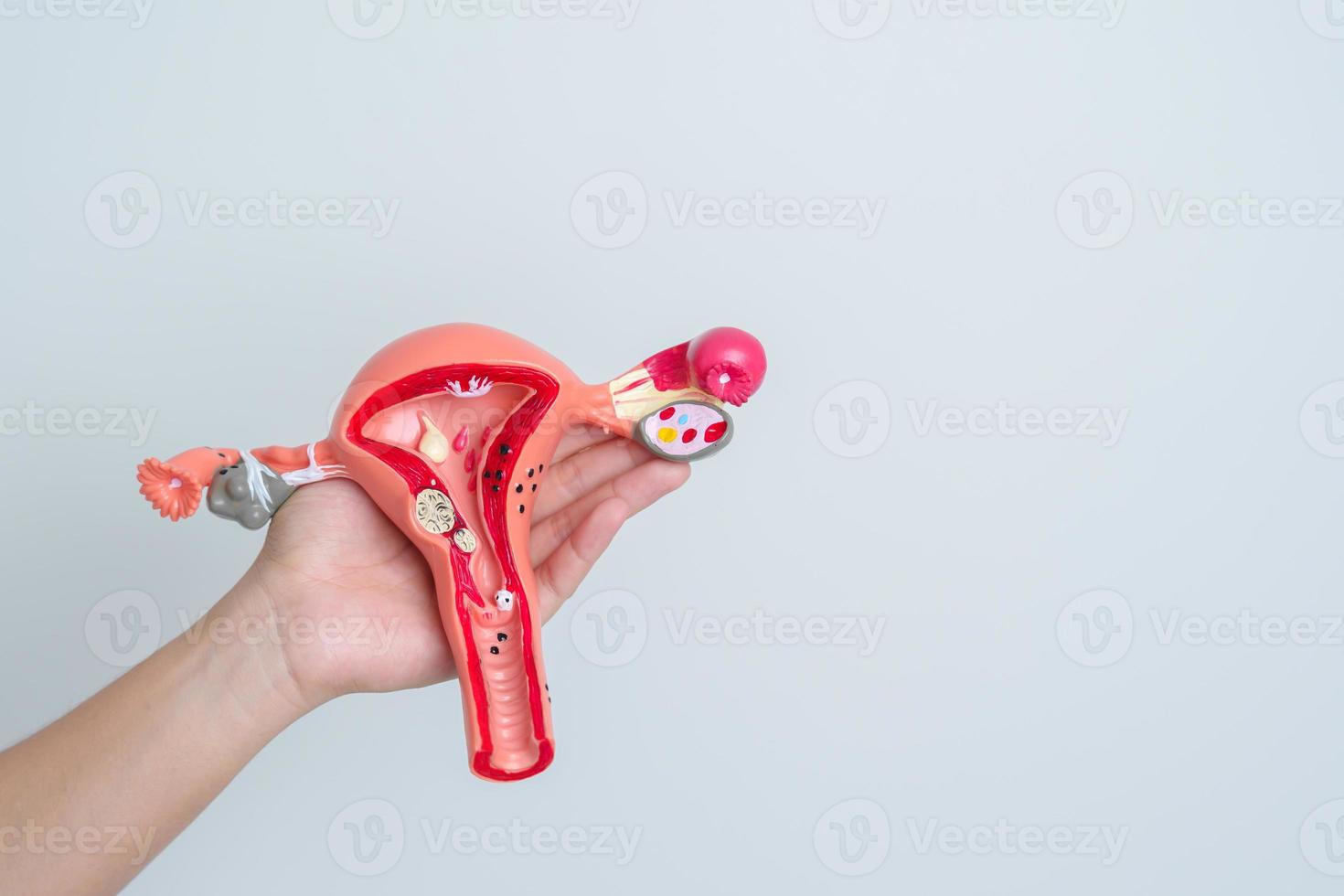 donna Tenere utero e ovaie modello. ovarico e cervicale cancro, cervice disturbo, endometriosi, isterectomia, uterino fibromi, riproduttore sistema e gravidanza concetto foto