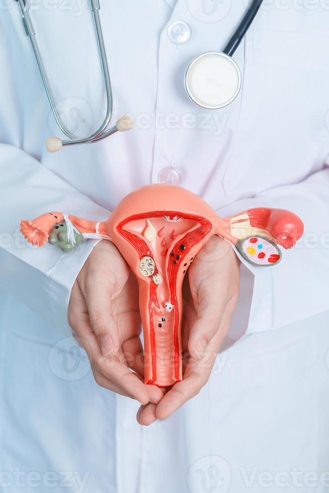 medico Tenere utero e ovaie modello. ovarico e cervicale cancro, cervice disturbo, endometriosi, isterectomia, uterino fibromi, riproduttore sistema e gravidanza concetto foto