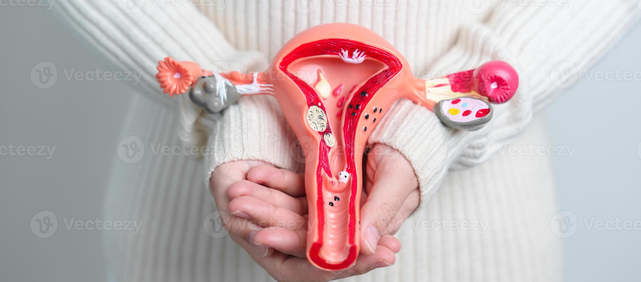 donna Tenere utero e ovaie modello. ovarico e cervicale cancro, cervice disturbo, endometriosi, isterectomia, uterino fibromi, riproduttore sistema e gravidanza concetto foto