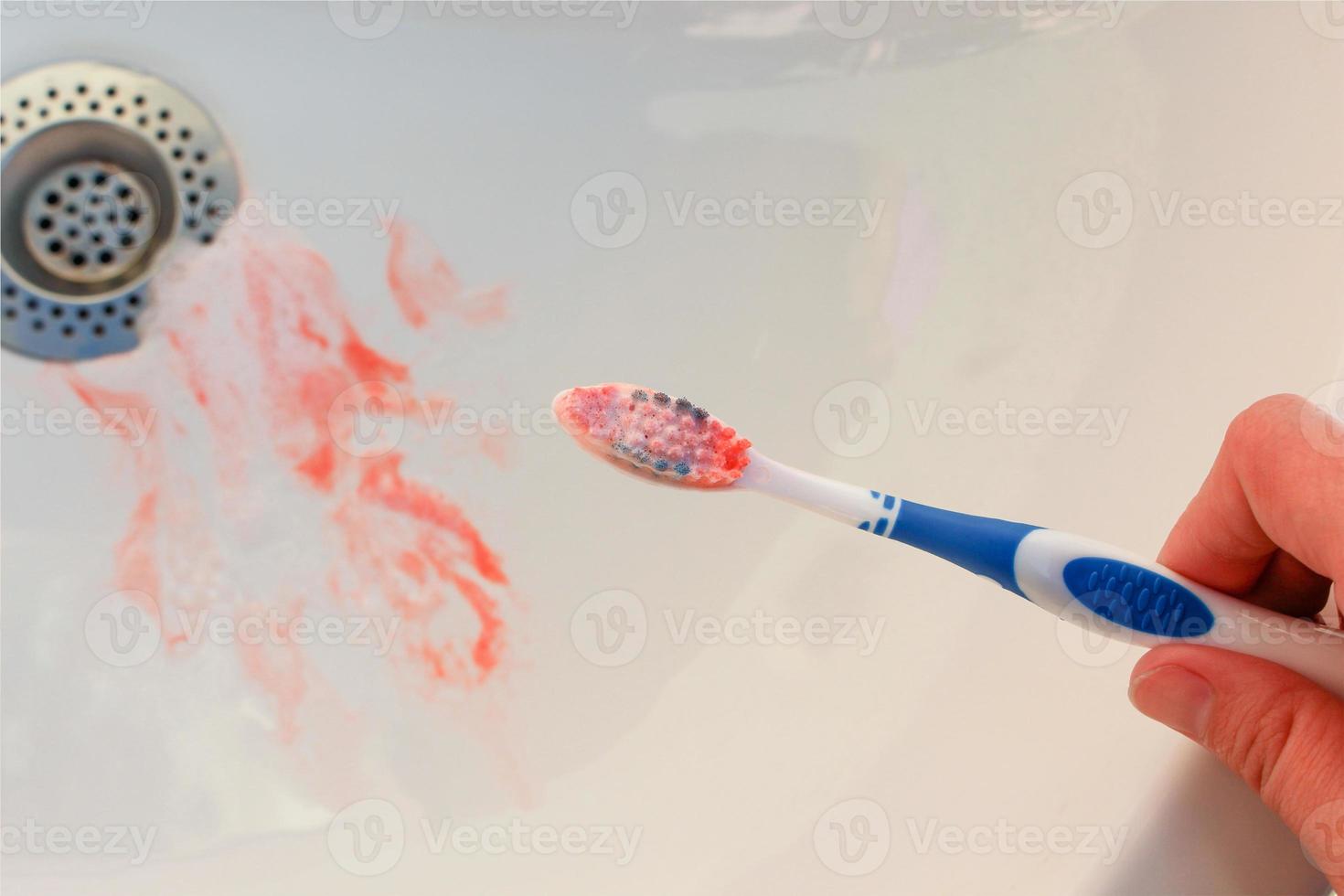 sangue su spazzolino su sfondo di lavello. foto