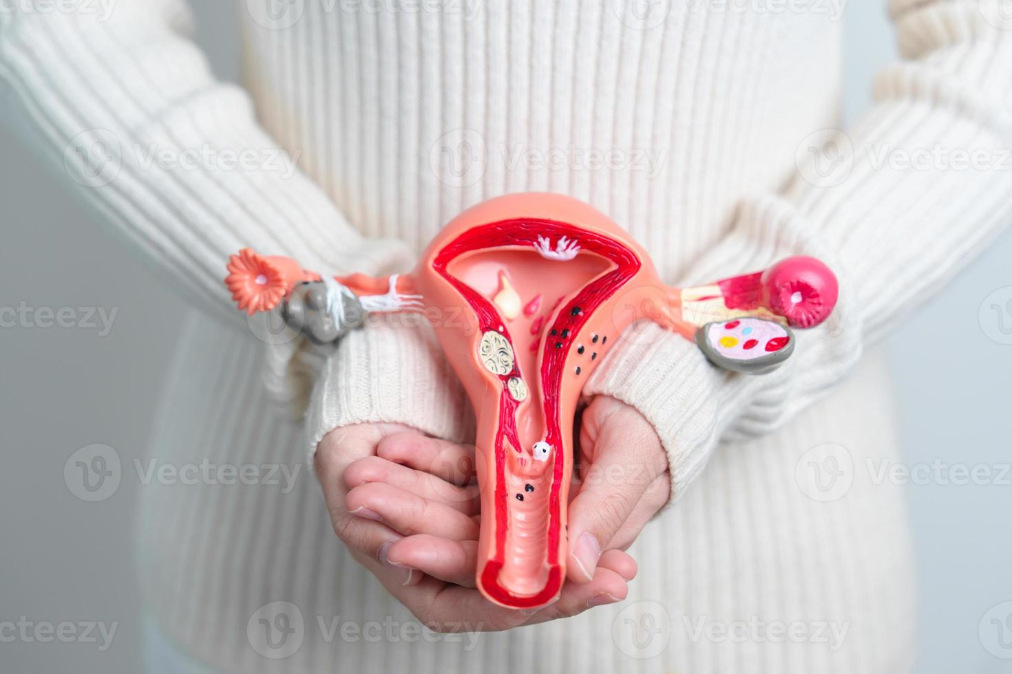 donna Tenere utero e ovaie modello. ovarico e cervicale cancro, cervice disturbo, endometriosi, isterectomia, uterino fibromi, riproduttore sistema e gravidanza concetto foto