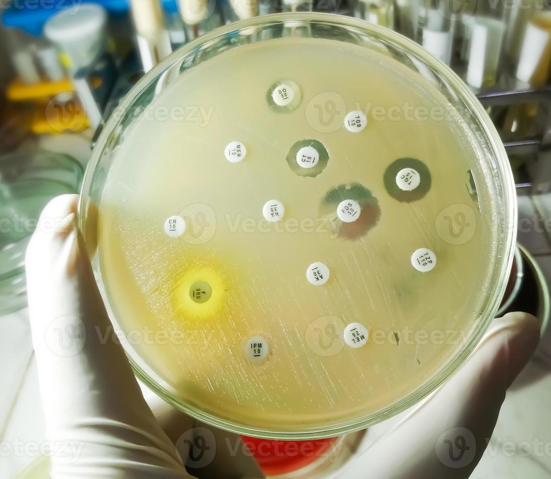 test di sensibilità antimicrobica in capsula di Petri. resistenza agli antibiotici dei batteri foto