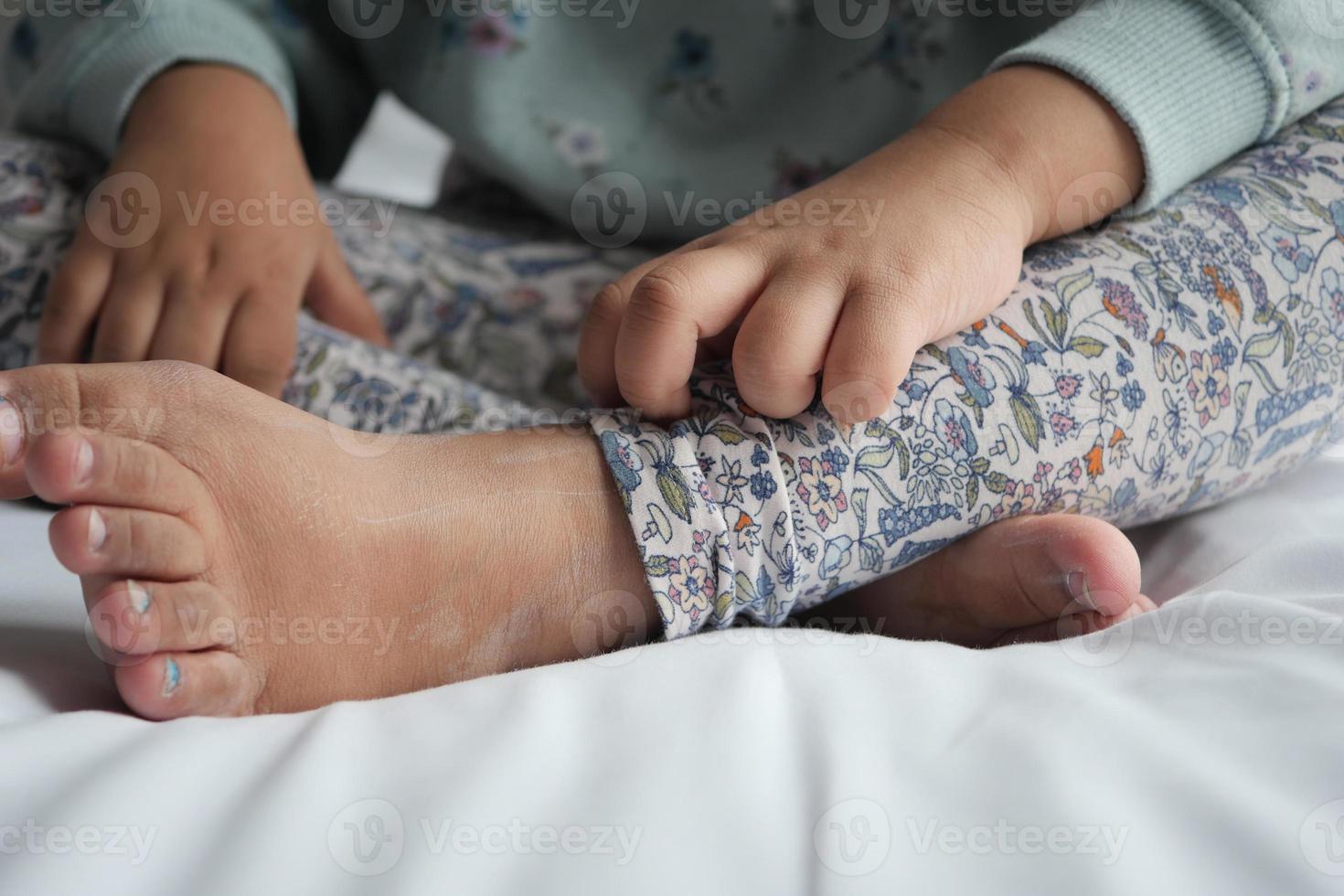 bambina che soffre di prurito della pelle, primo piano. foto