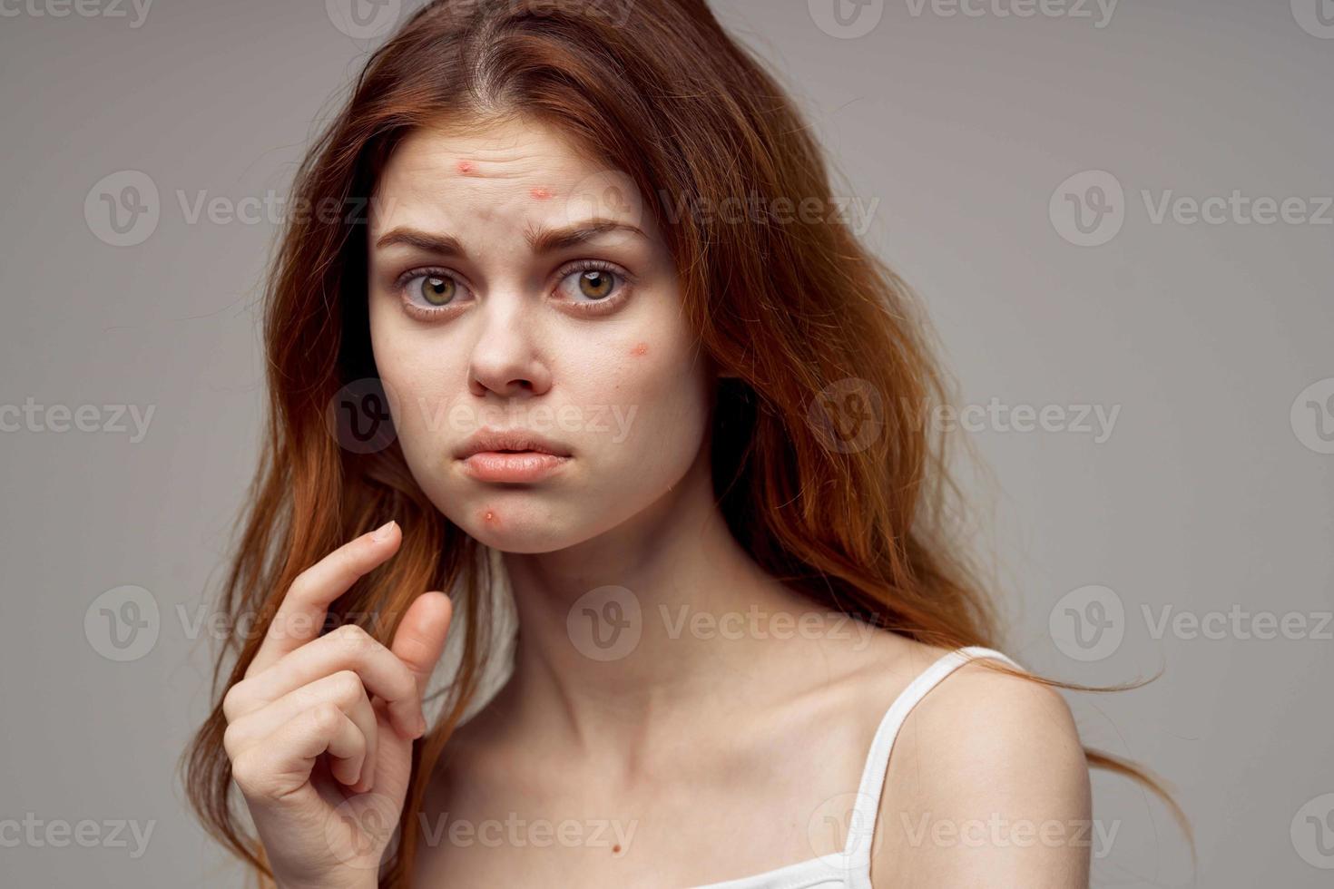 bellissimo donna nel un' bianca maglietta brufoli su il viso isolato sfondo foto