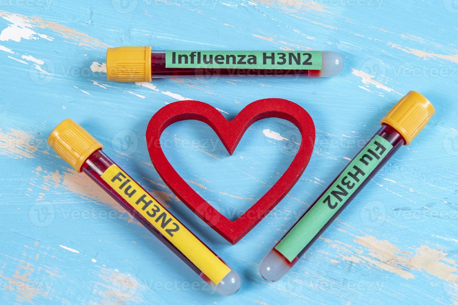 vuoto tubo per sangue collezione scritto influenza h3n2 nel riferimento per il influenza genere foto