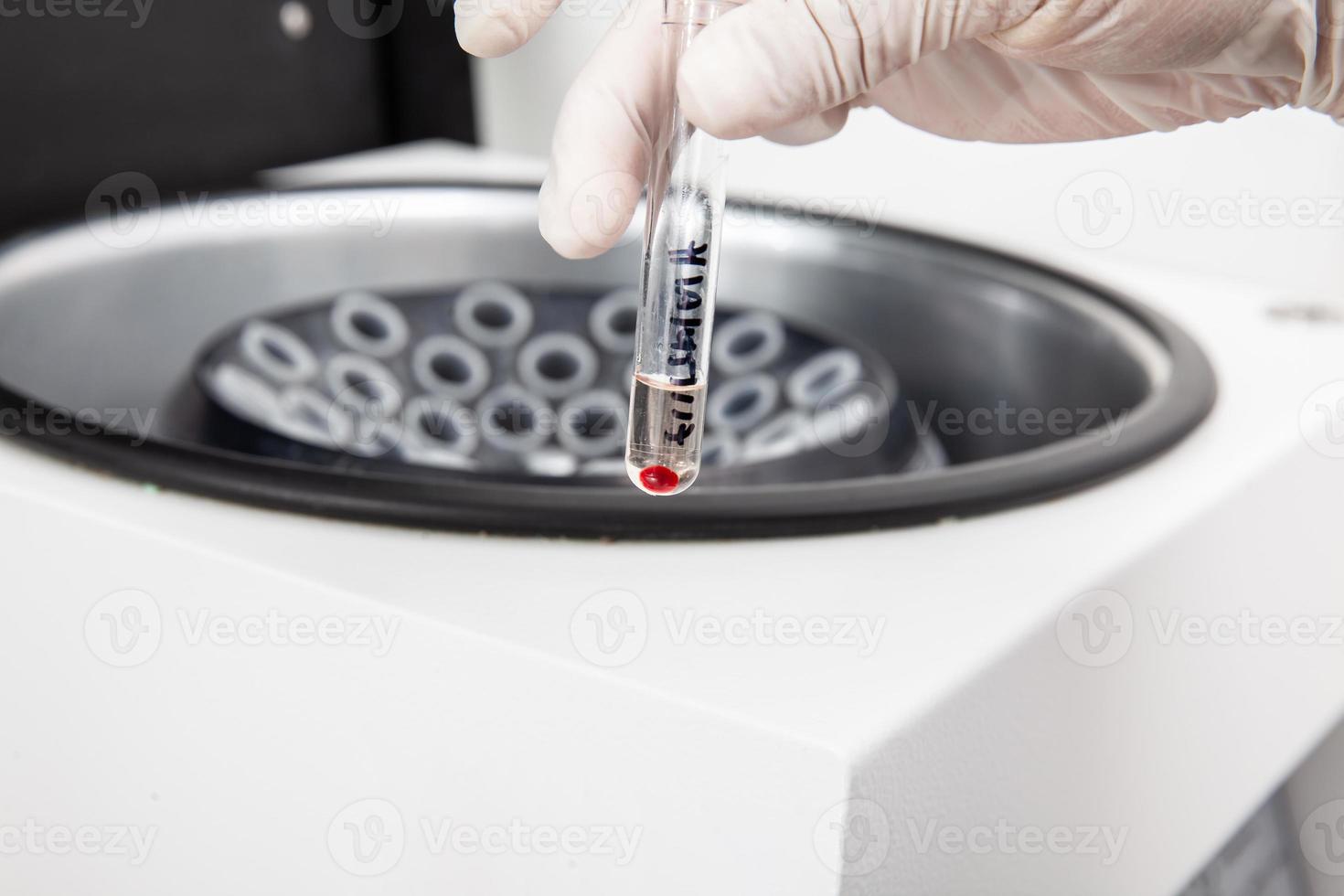 test tubo con osso midollo cellule pellet ottenuto dopo centrifugazione. scienziato preparazione osso midollo campioni per flusso citometrico analisi nel il laboratorio. foto