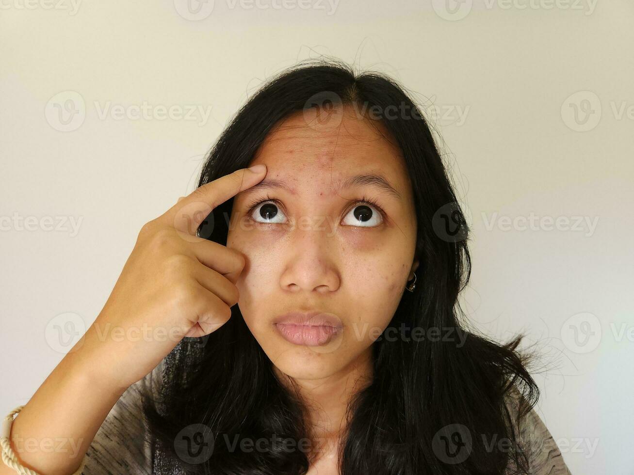 asiatico donna preoccupato di acne su sua fronte isolato su bianca foto