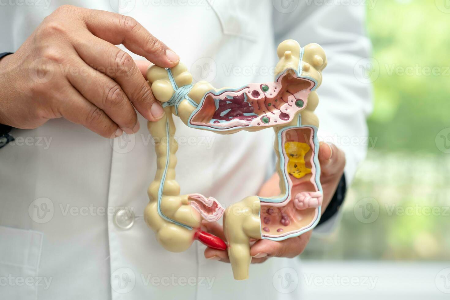 intestino, appendice e digestivo sistema, medico Tenere anatomia modello per studia diagnosi e trattamento nel Ospedale. foto