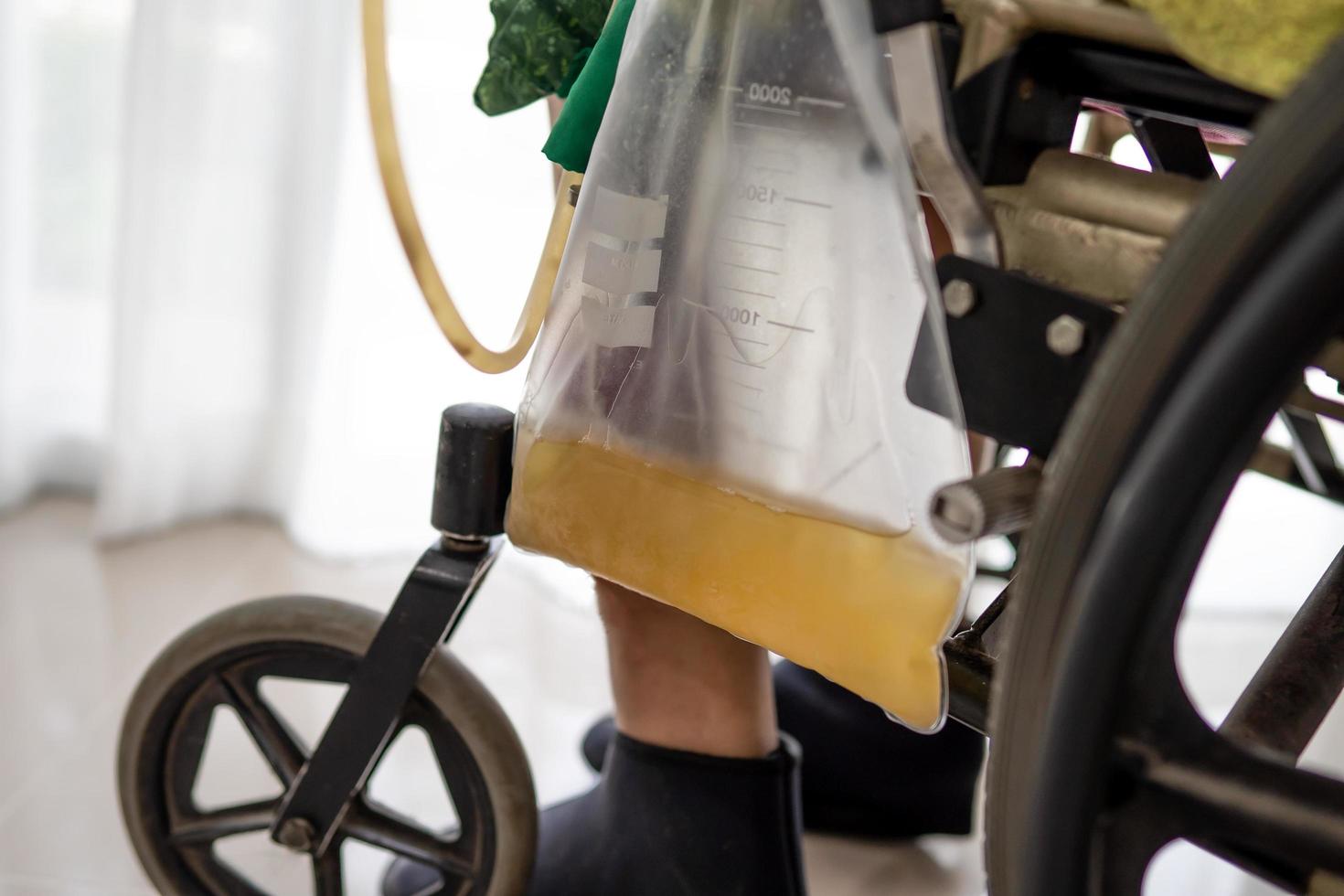 paziente asiatico della donna della signora che si siede sulla sedia a rotelle con il sacchetto dell'urina nel reparto di ospedale foto