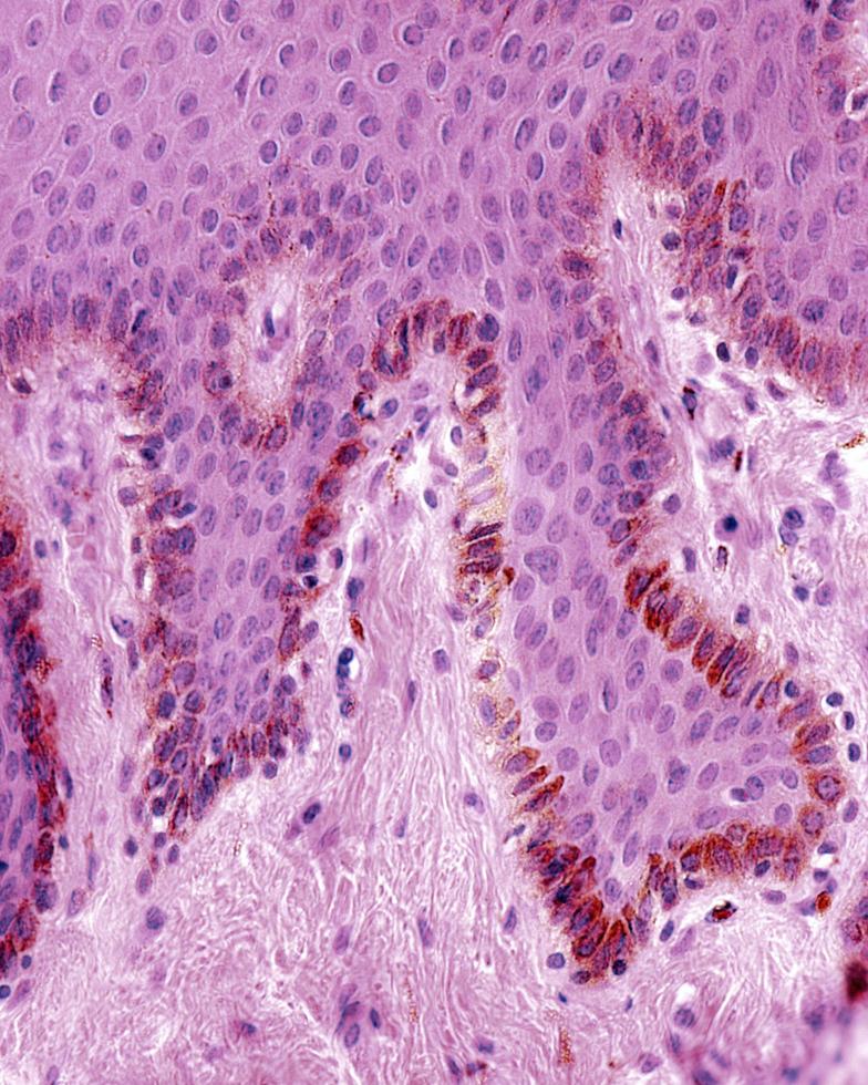 melanociti dell'epidermide umana foto