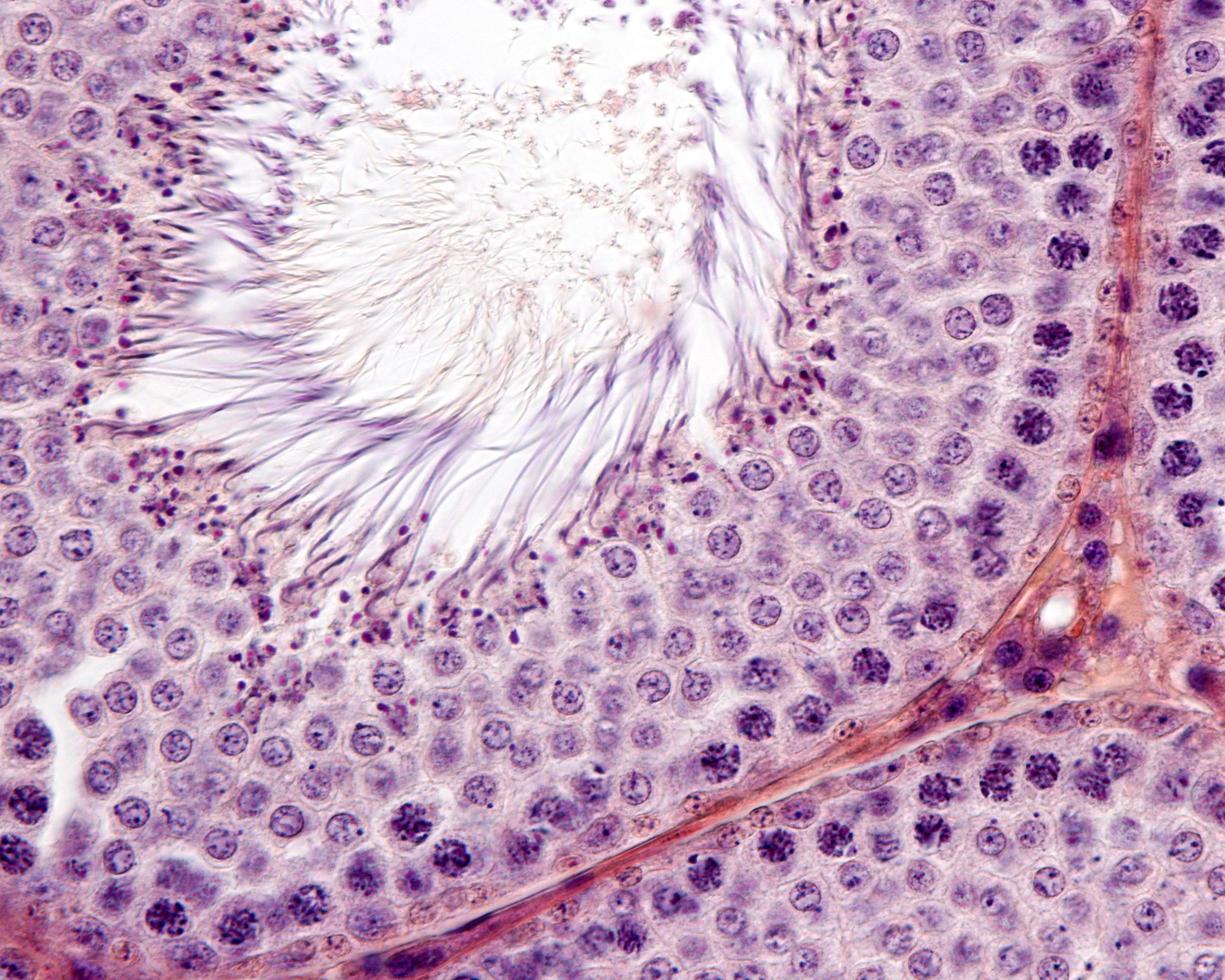 spermatogenesi dei tubuli seminiferi foto