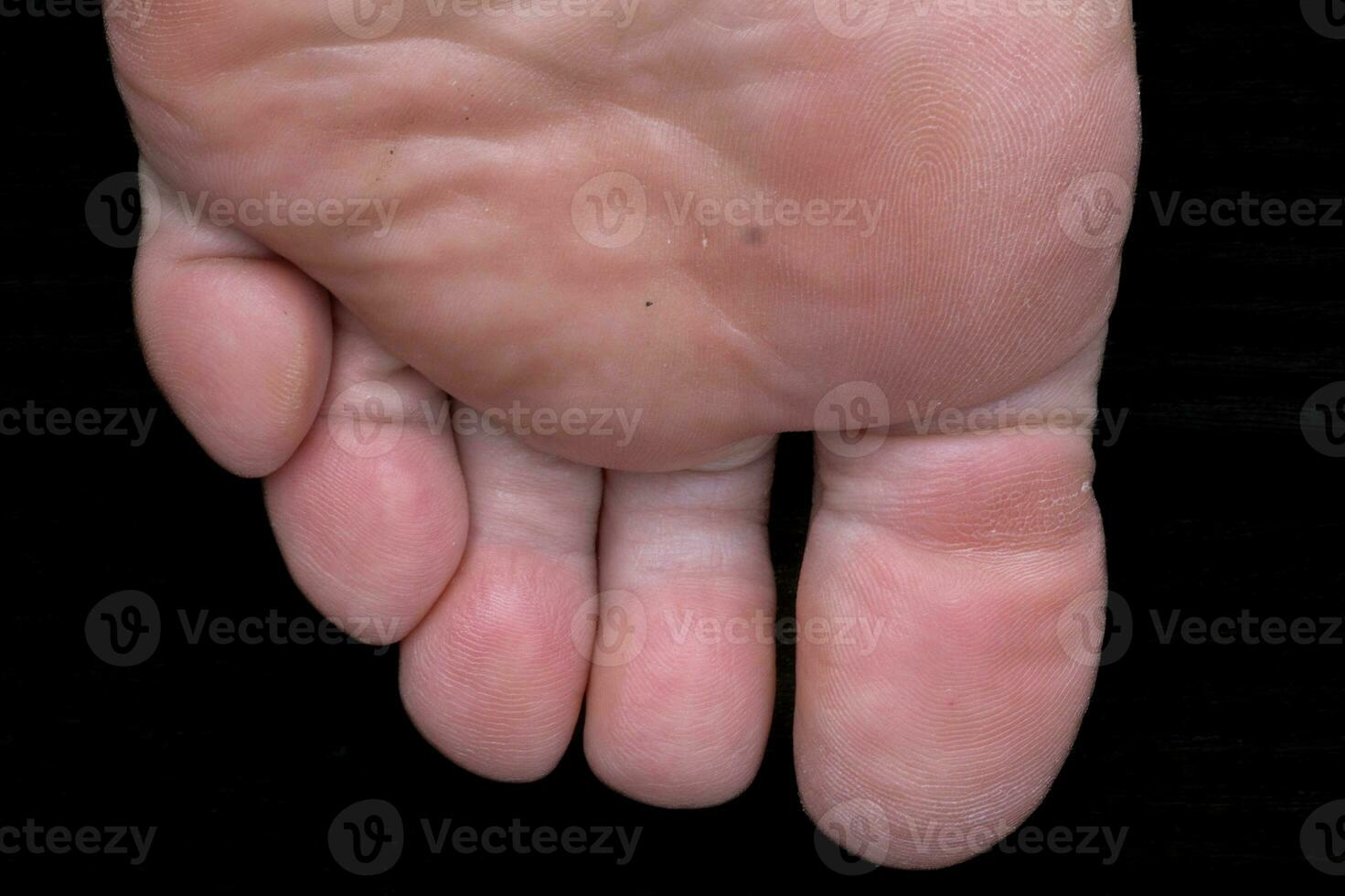 dita dei piedi di un' piede di un' umano a partire dal sotto foto