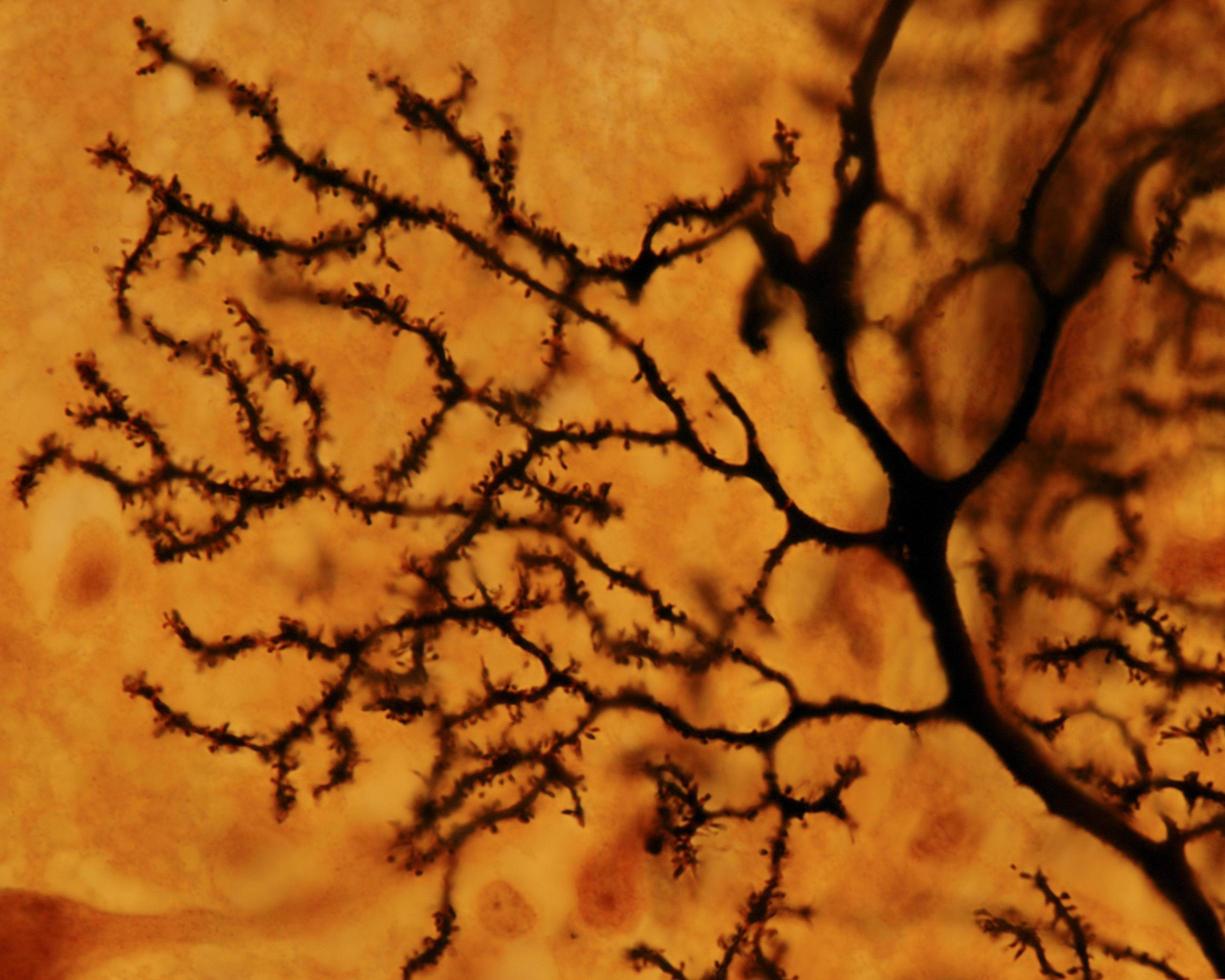 spine dendritiche del neurone di purkinje foto