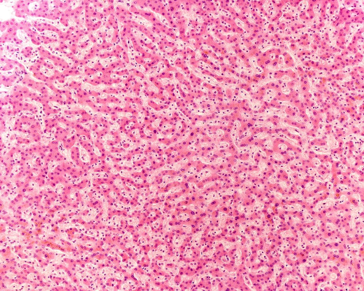 microfotografia del fegato umano foto