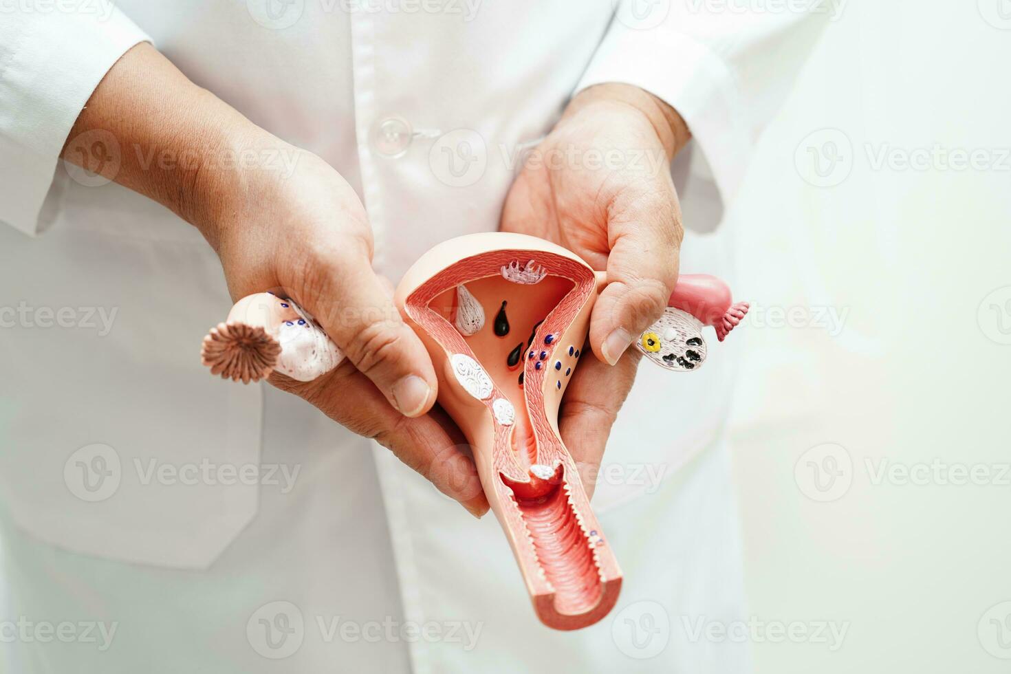 utero, medico Tenere anatomia modello per studia diagnosi e trattamento nel Ospedale. foto