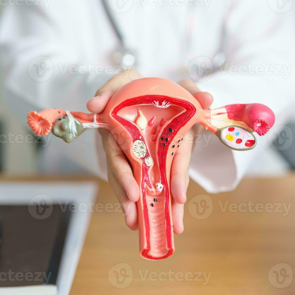 medico con utero e ovaie anatomia modello. ovarico e cervicale cancro, cervice disturbo, endometriosi, isterectomia, uterino fibromi, riproduttore sistema, gravidanza e Salute concetto foto