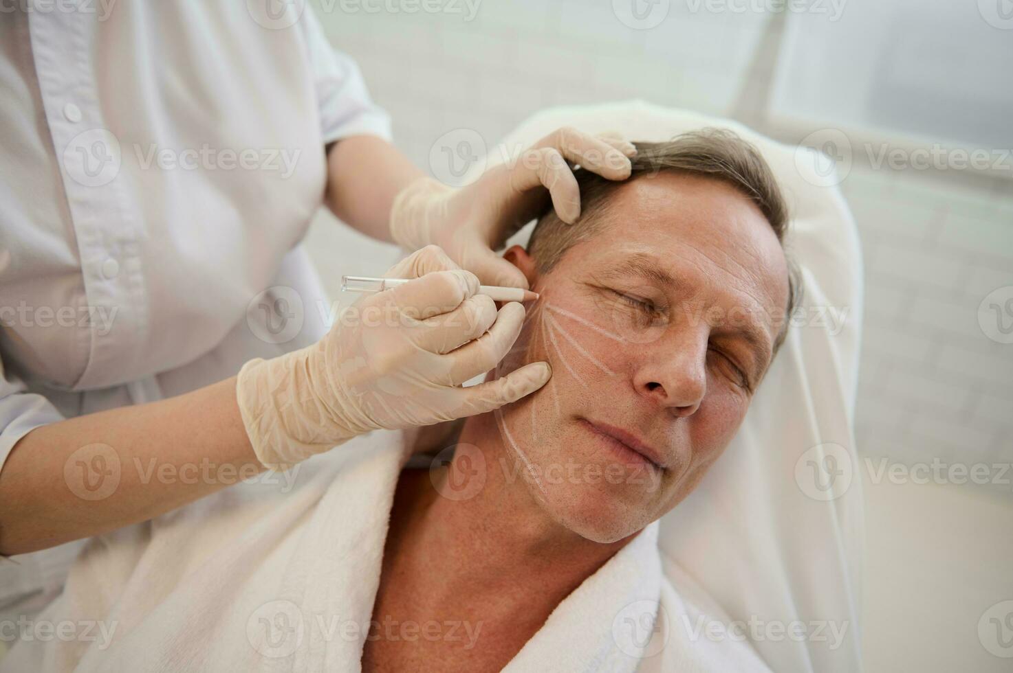 cosmetologo disegna linee guida per iniezione di cosmetico Prodotto con bianca matita. filo lifting con frecce per maschio pelle, facciale contouring procedura con meso discussioni per facciale ringiovanimento foto