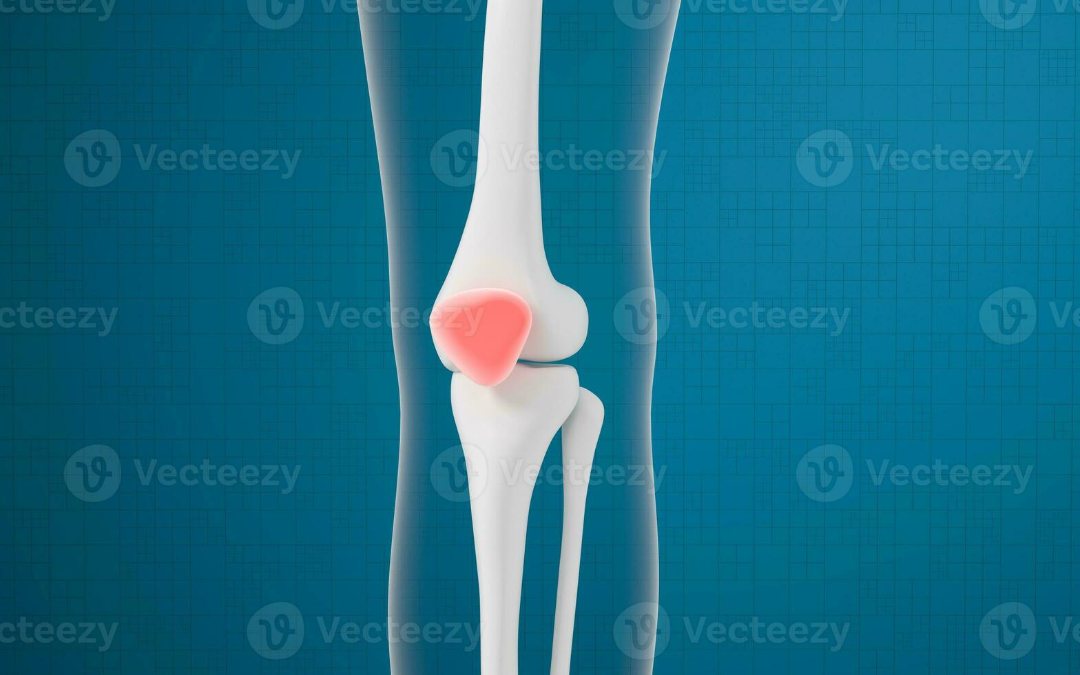 gamba osso e ginocchio lesioni, 3d resa. foto