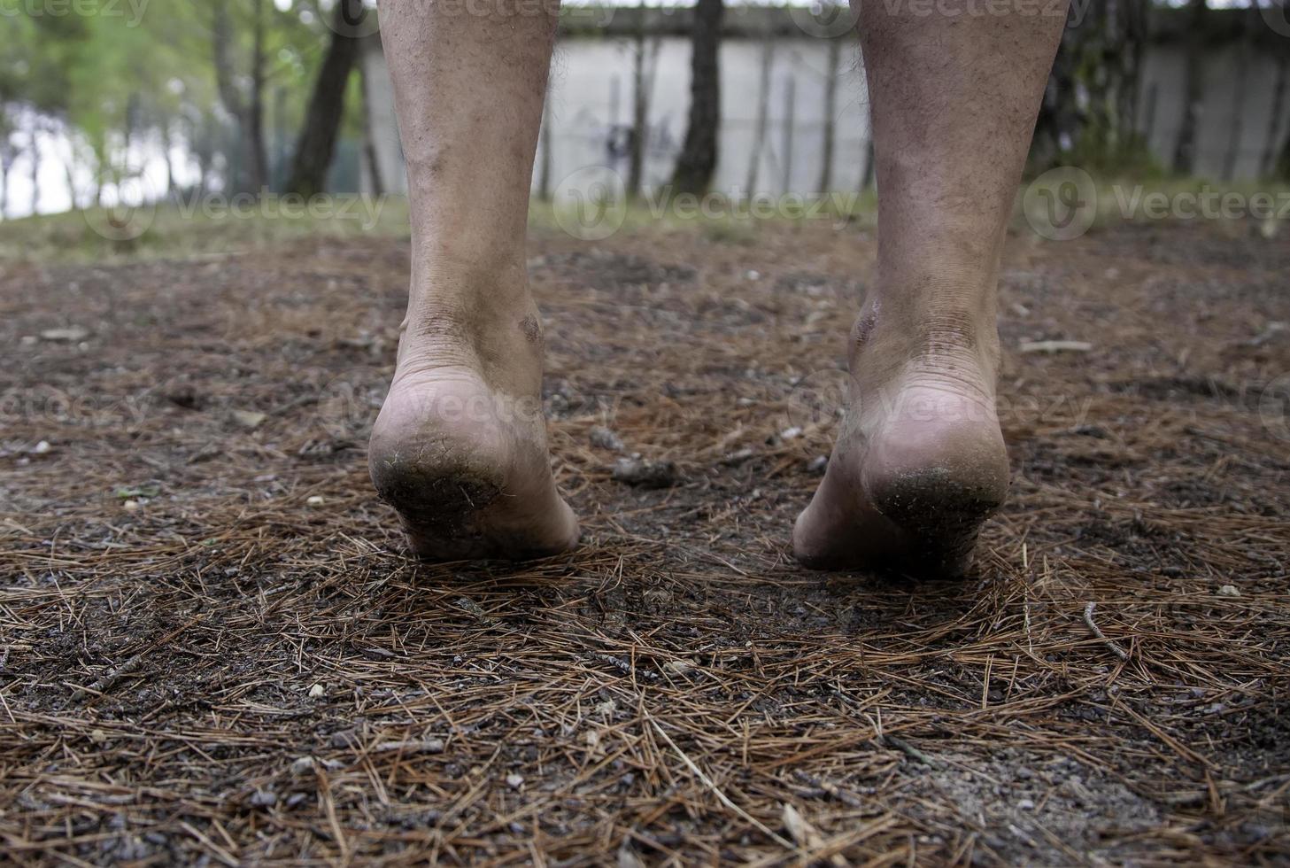 piedi sporchi nella foresta foto