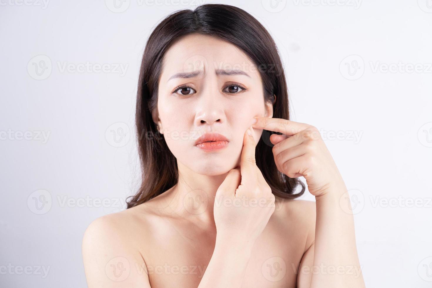 la donna asiatica è a disagio con l'acne sul viso foto