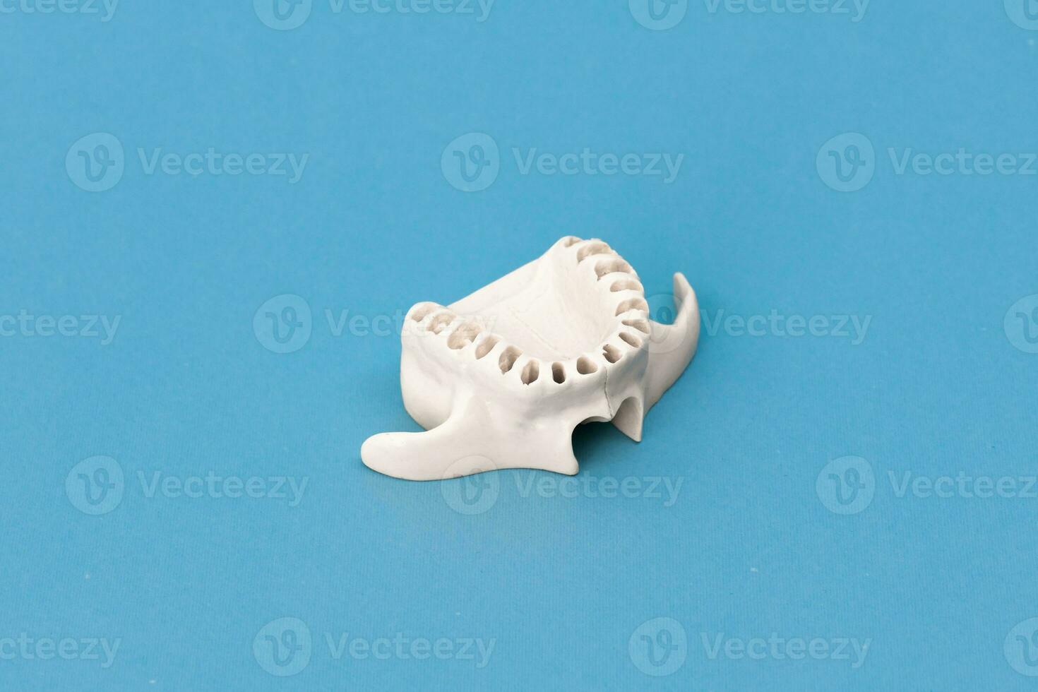 superiore umano mascella senza denti modello medico impiantare isolato su blu sfondo. salutare denti, dentale cura e ortodontico concetto. foto