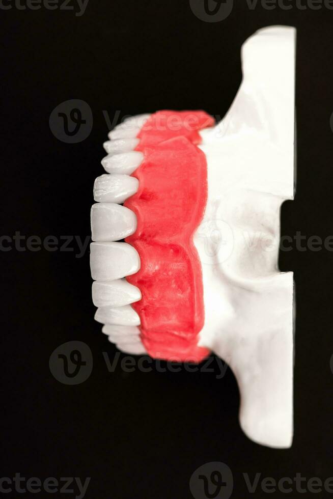 denti impiantare e corona installazione processi parti isolato su un' blu sfondo. medico preciso 3d modello. foto