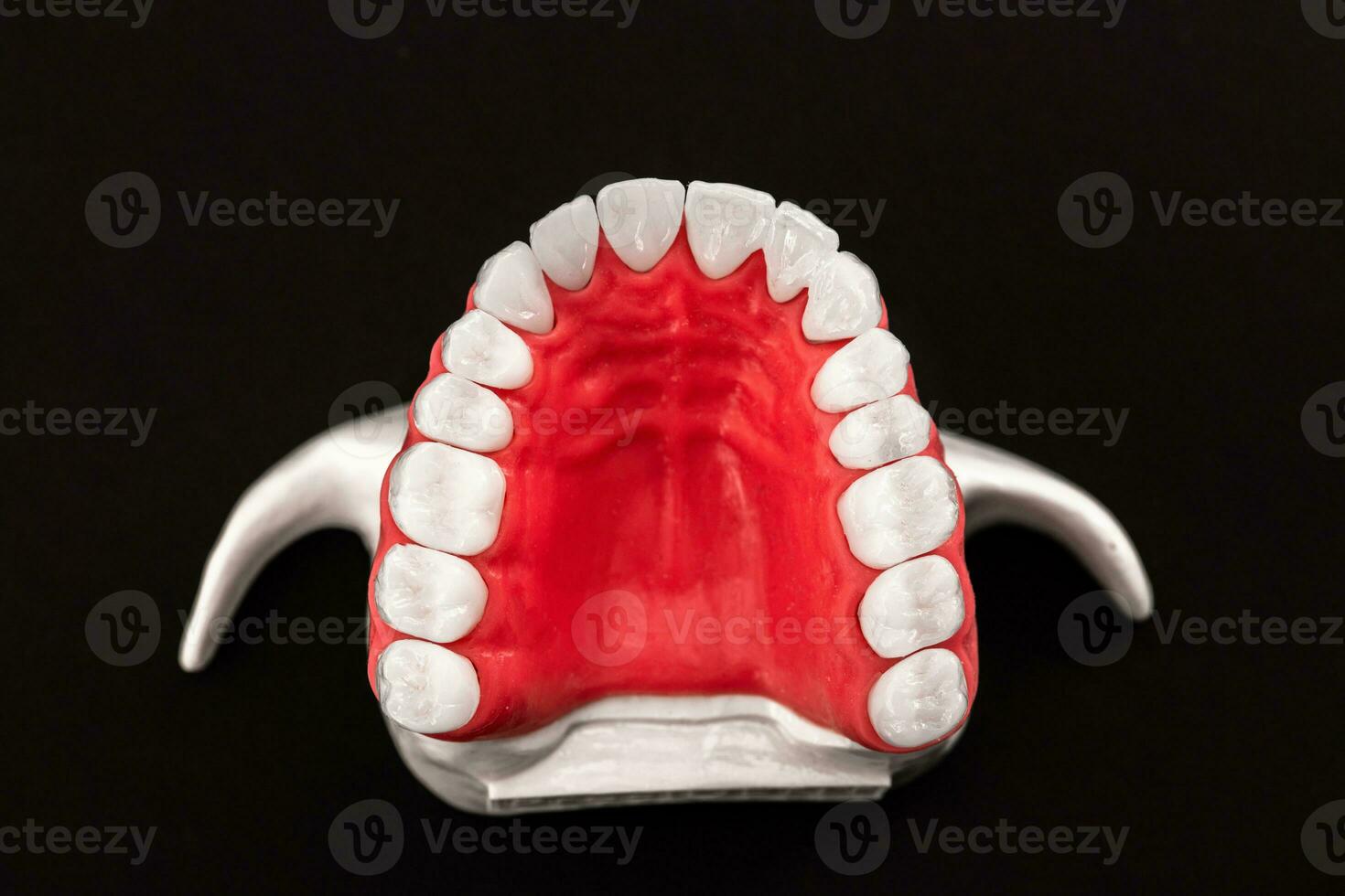 denti impiantare e corona installazione processi parti isolato su un' blu sfondo. medico preciso 3d modello. foto