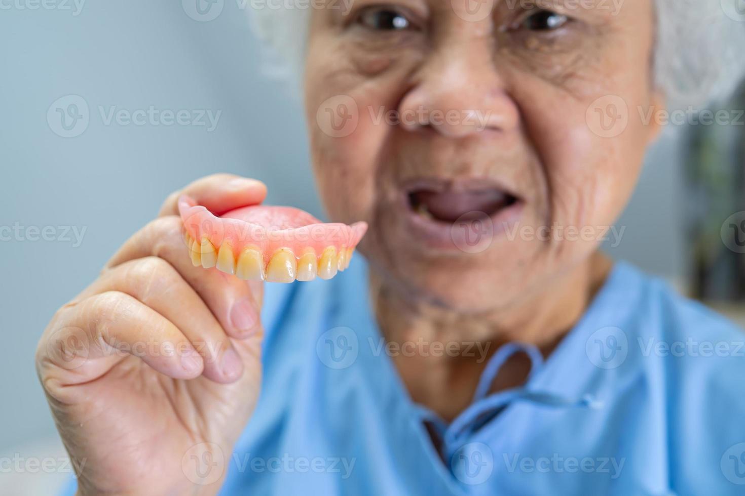 paziente senior asiatico della donna che tiene per usare la dentiera? foto