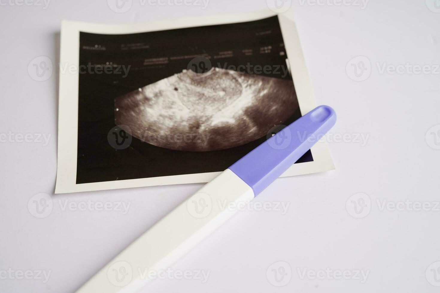 gravidanza test con ultrasuono scansione foto di feto, maternità, parto, nascita controllo.