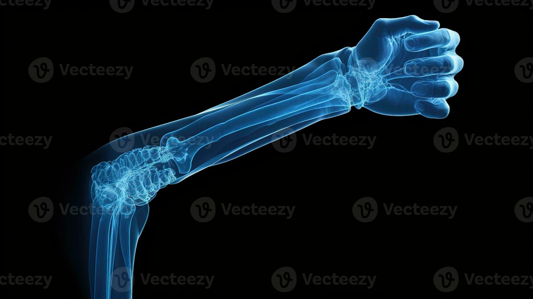 ortopedico eccellenza, dettagliato raggi X di un' maschio umano braccio nel blu toni su un' nero sfondo - ideale per preciso medico l'imaging e diagnosi, ai generativo foto