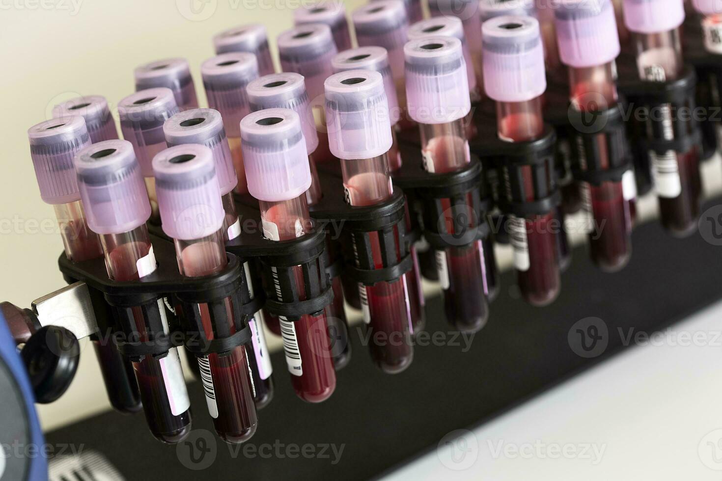tubo sangue campione nel un' medico visita medica. foto
