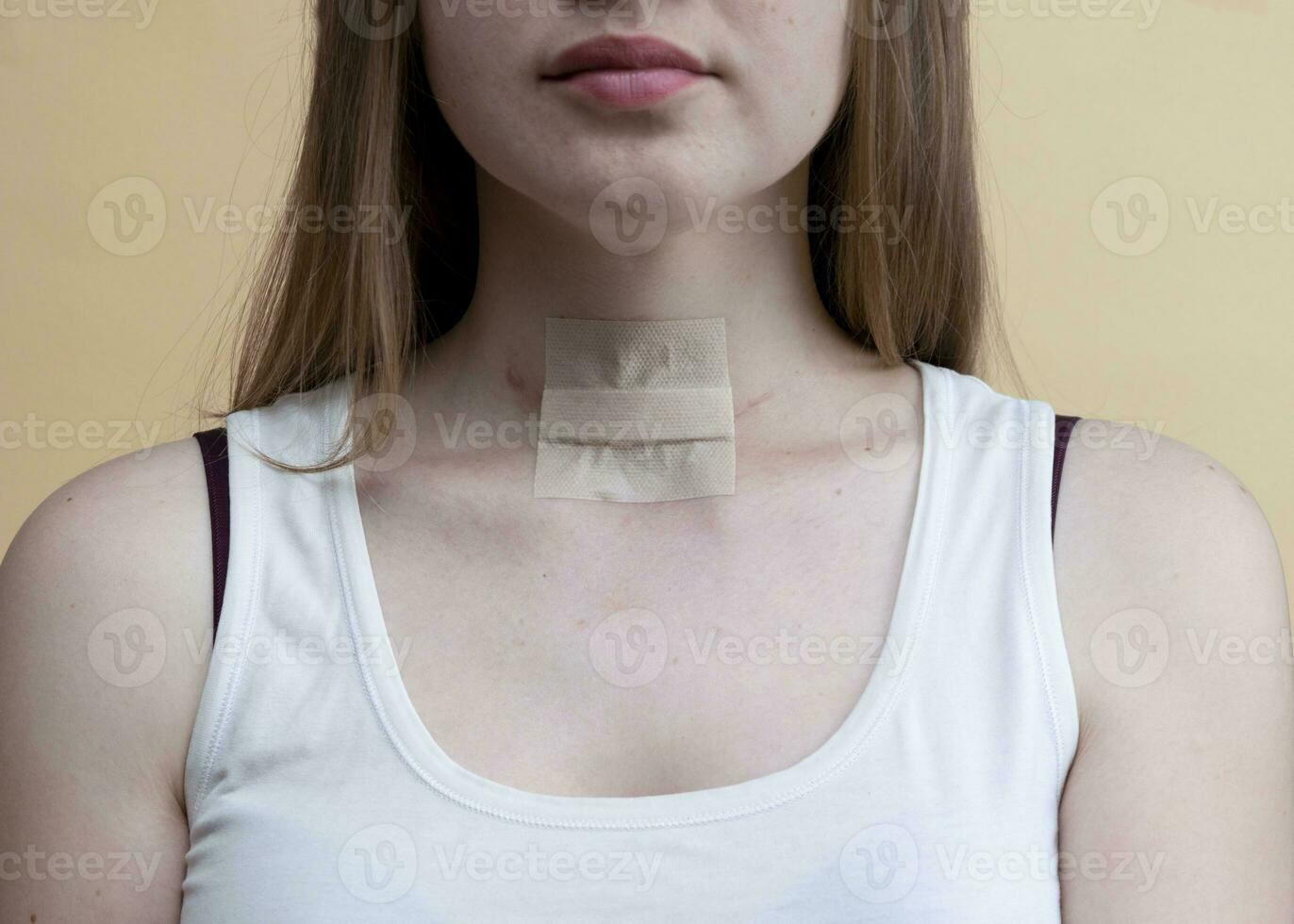 cicatrice dopo chirurgia su donna collo foto