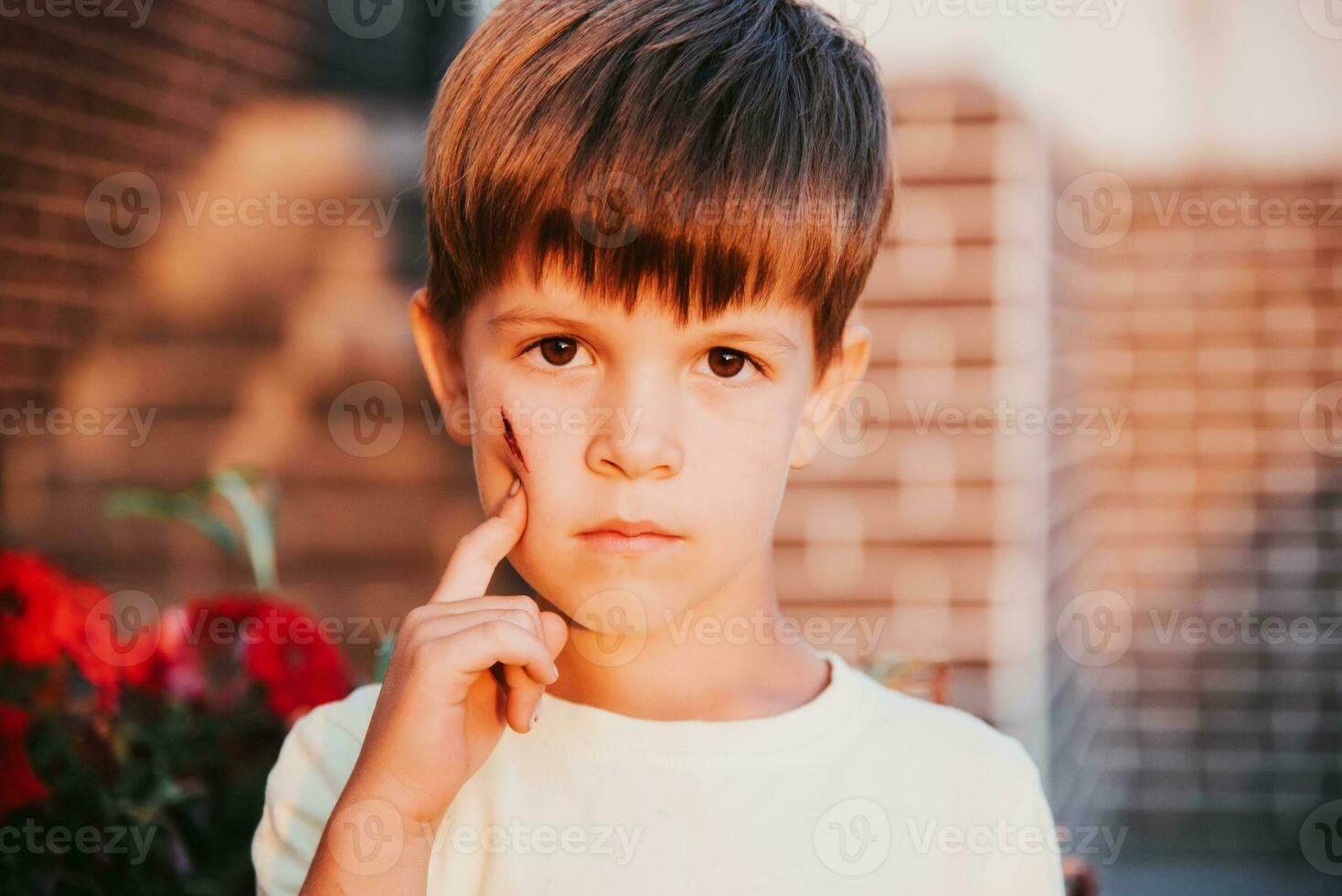 ritratto di un' carino ragazzo con un' livido su il suo viso foto