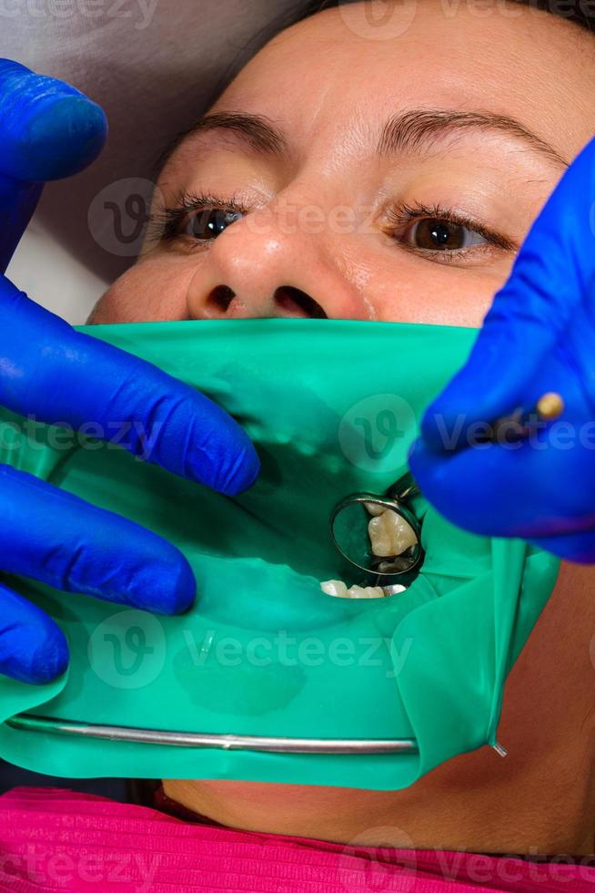 il dentista tratta il dente del paziente con una diga di gomma foto