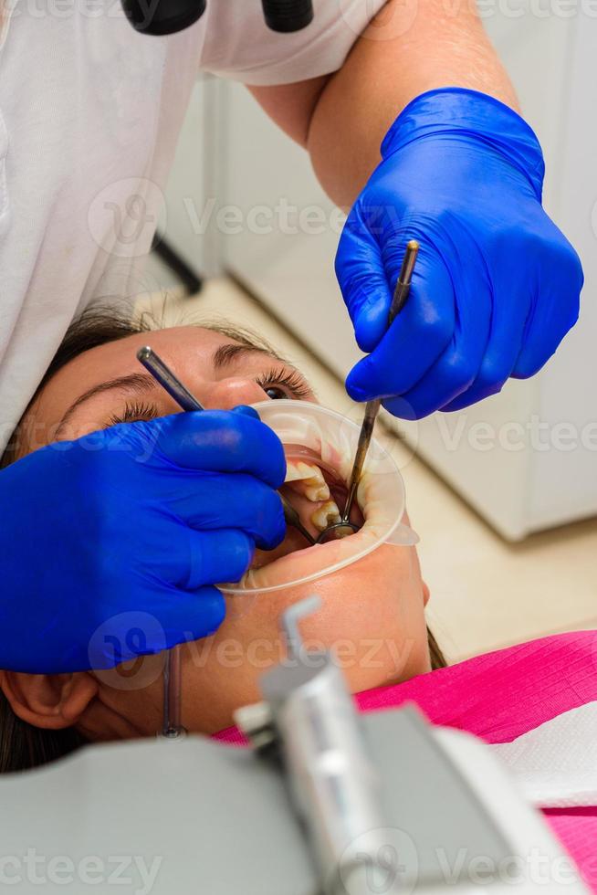 l'uso di un divaricatore mentre ci si lava i denti dal tartaro. foto